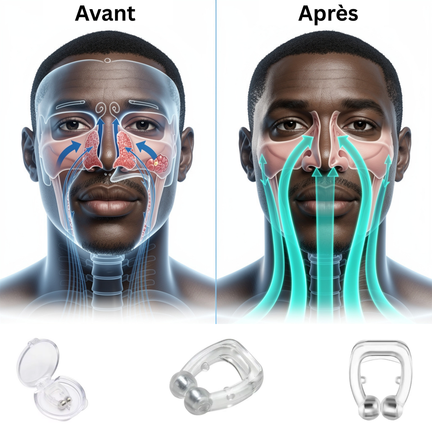 Clip anti-ronflement